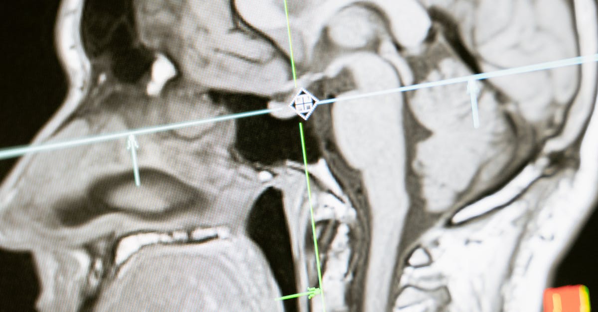 Overview of Medical Radiation and its Hazards