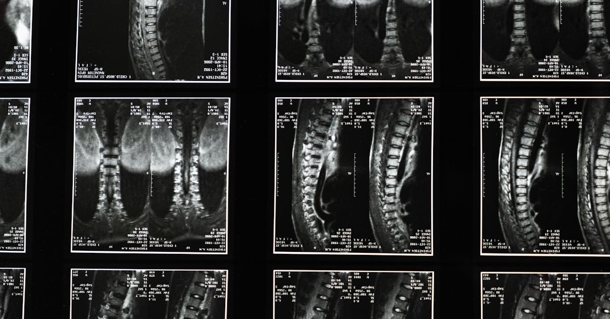 Radiation Dose Considerations in Medical Imaging