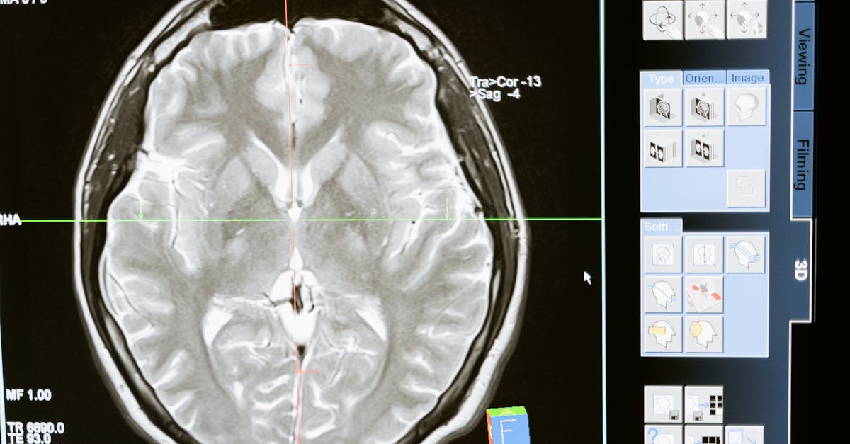 Common Medical Radiation Related Diseases and Conditions